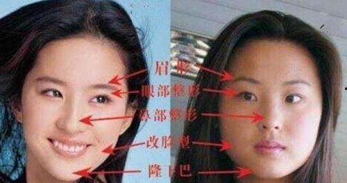 爆料刘亦菲整容视频,揭秘明星美容秘密